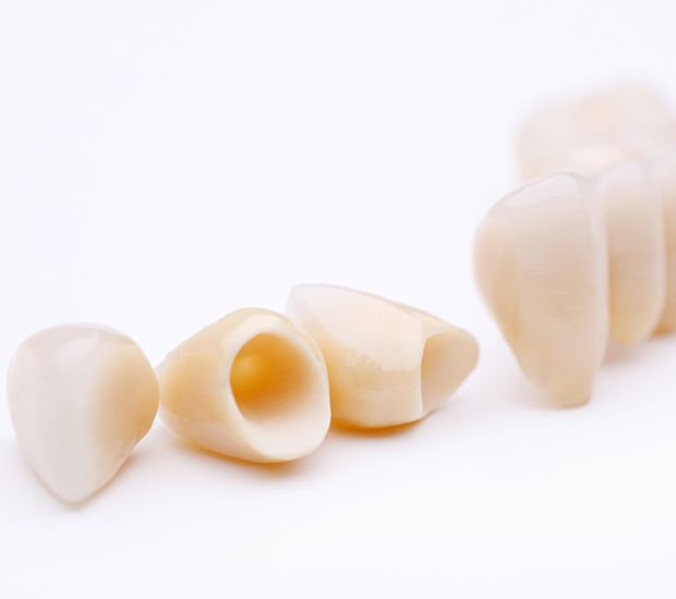 Union Dental Crowns and Dental Bridges